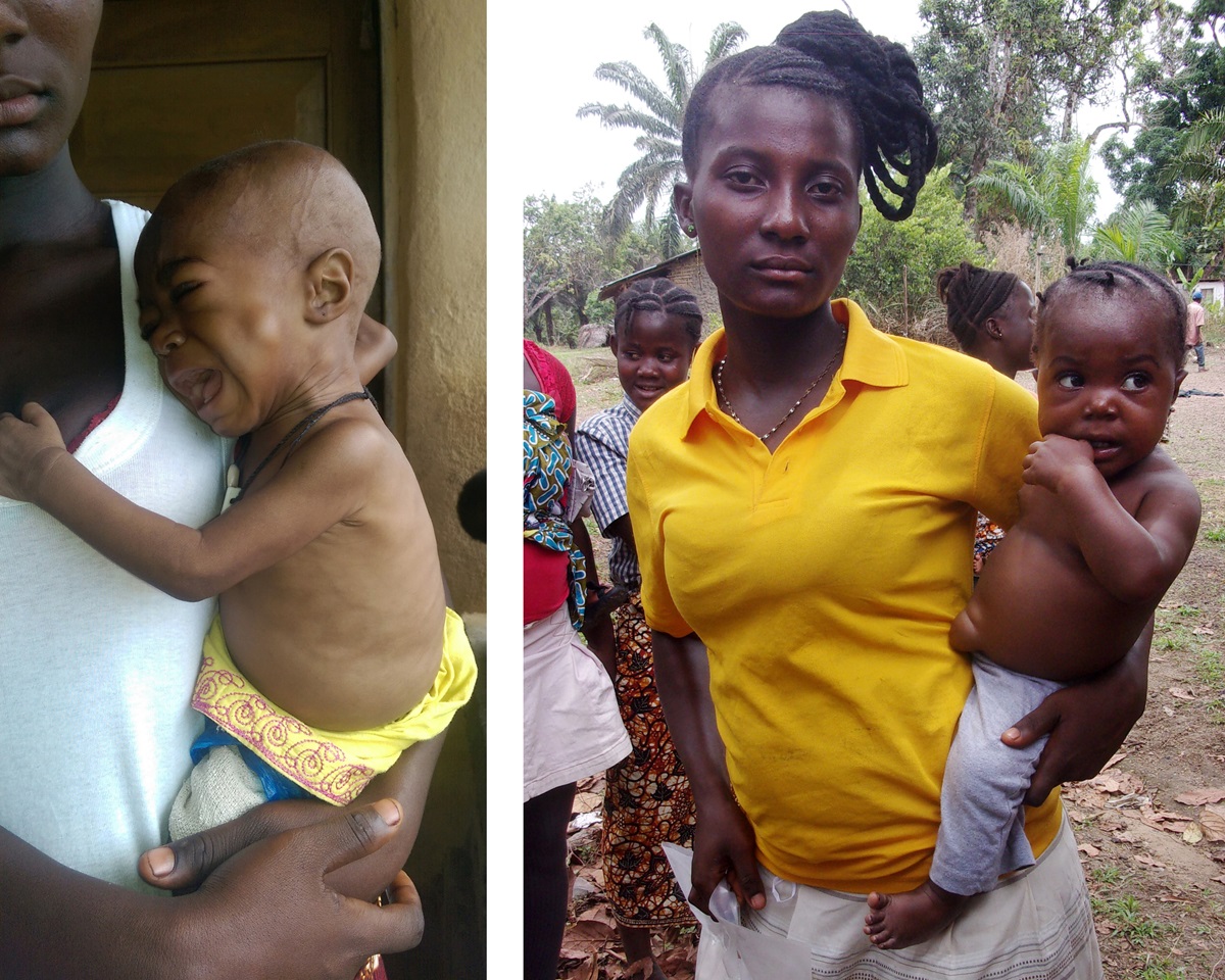 “Baby Betty” is one of United Methodist Mercy Hospital’s success stories. The photo at left shows the child when she was first seen at the clinic. Mohamed Khadar, the hospital’s outreach manager, says she was severely malnourished and sick with pneumonia. She was treated and put on a special diet. The photo at right shows her now, over 2 years old and healthy. Photos courtesy of Phileas Jusu and Mercy Hospital.