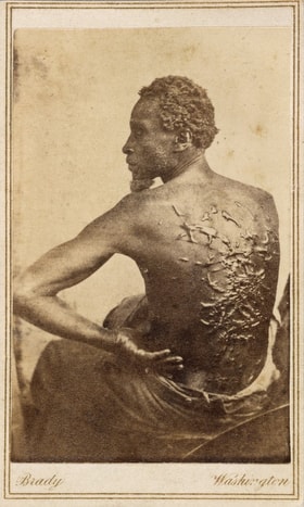 Scars from whipping cover the back of a slave from Mississippi as he sat for a medical examination at a Union Army camp in Baton Rouge, La., in 1863. The original caption reads "overseer Artayou Carrier whipped me. I was two months in bed sore from the whipping. My master come after I was whipped; he discharged the overseer. The very words of poor Peter, taken as he sat for his picture." Photo by Mathew Brady, National Portrait Gallery, Smithsonian Institution.