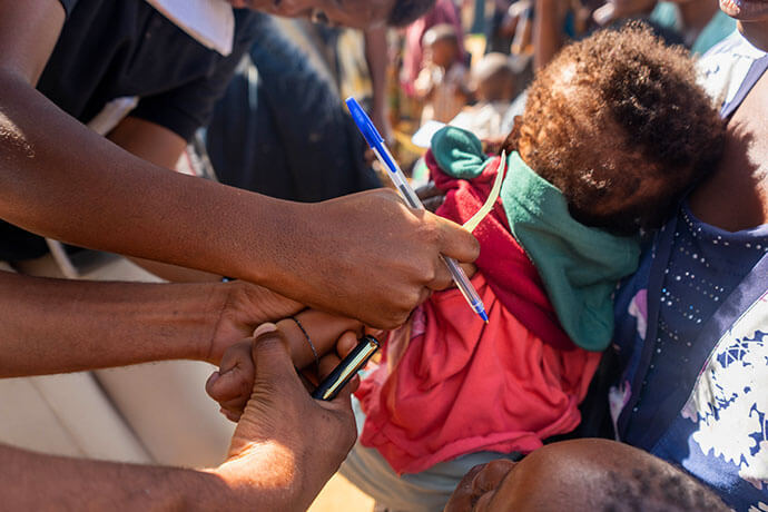 Des responsables du programme de nutrition mesurent la circonférence du bras supérieur d'un bébé pour dépister la malnutrition pédiatrique au camp de réfugiés de Dzaleka, dans le district de Dowa, au Malawi. Ce dépistage fait partie d'un programme de l'Eglise méthodiste unie qui offre des services de santé et de nutrition dans le camp. Photo par Francis Nkhoma, UM News.